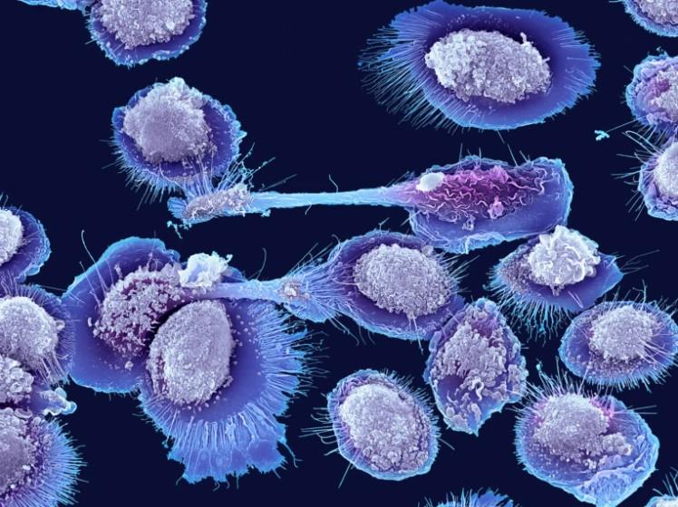 New Ultra-Fast Genome Sequencing Technology Holds Promise for Accelerating Aging Research