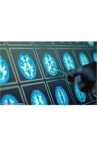 مغز انسان 3 موج پیری را تجربه می‌کند